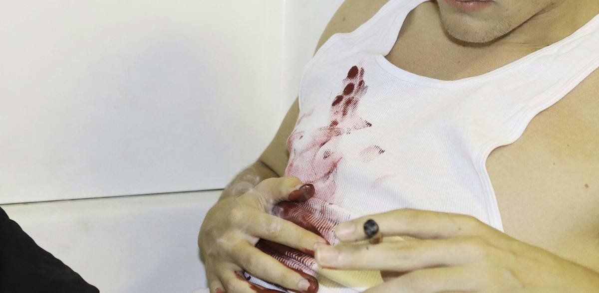 side-by-side comparison of amateur vs professional special effects makeup for wounds demonstrating depth and color variation