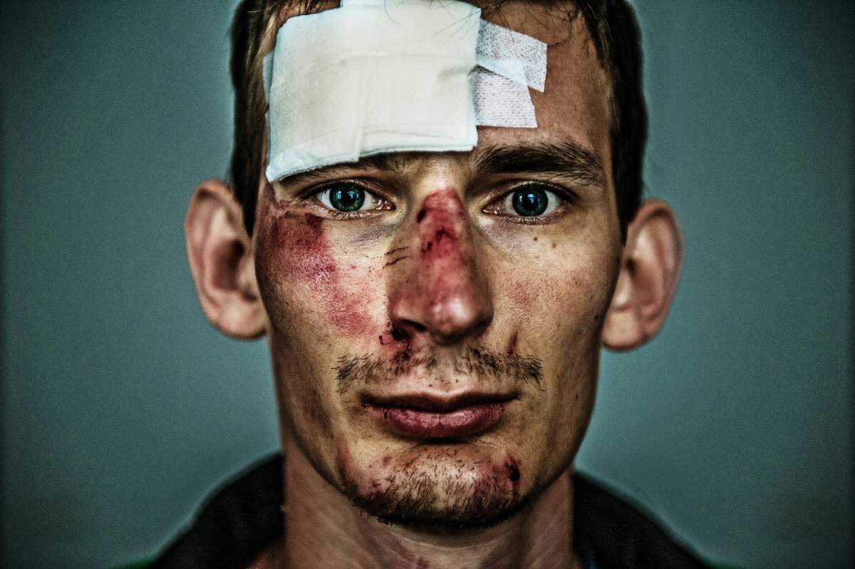 close-up of special effects makeup for wounds showing layered texture and realistic blood pooling